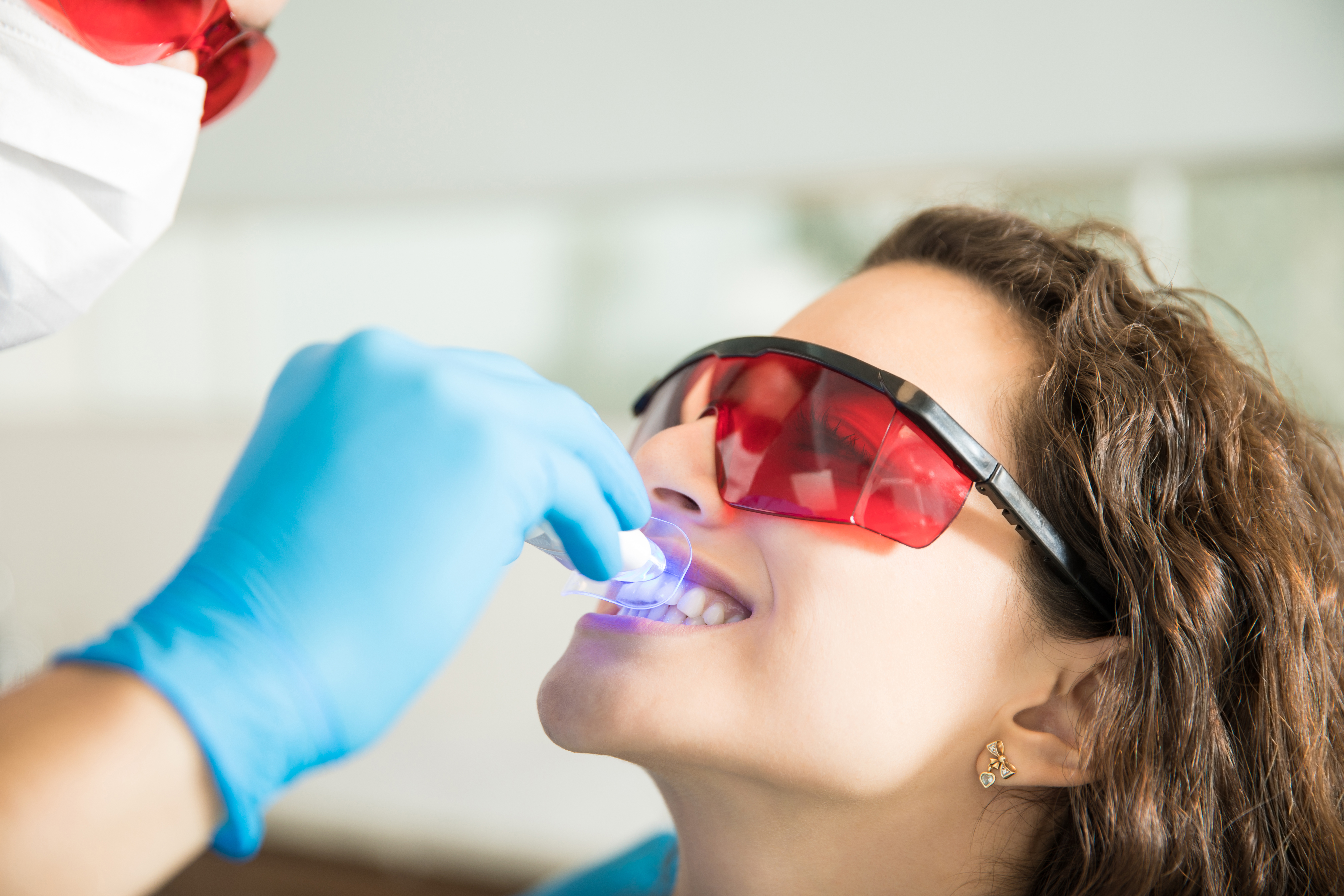 Clareamento dental: mitos e verdades